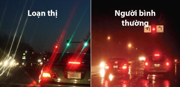 Tại sao trẻ bị mắc cận thị?