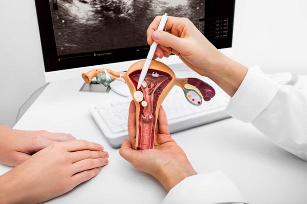 U xơ tử cung xuất hiện tại nhiều vị trí và có thể gây ra nhiều ảnh hưởng tới sức khỏe của người bệnh