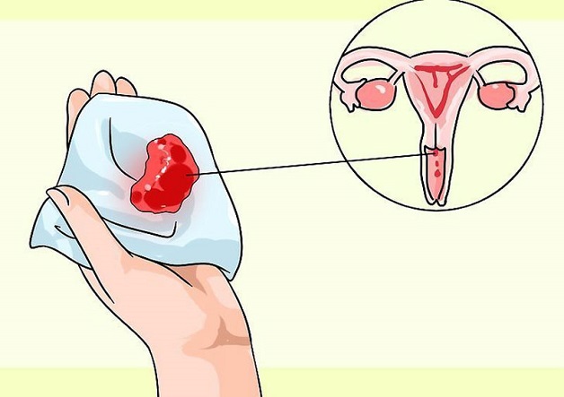 rà soát ung thư cổ tử cung