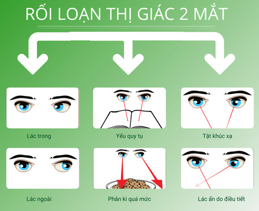 Rối loạn thị giác