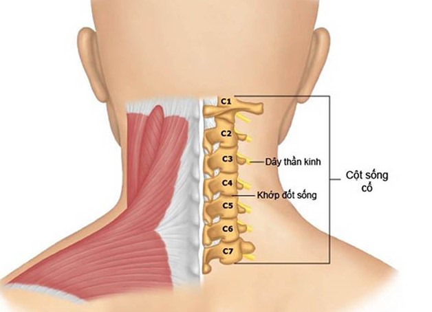 Thoái hóa đốt sống cổ gây ra rất nhiều ảnh hưởng cho sức khỏe và vận động của người bệnh