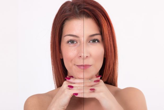 Đang bị u xơ tử cung có uống được collagen không?