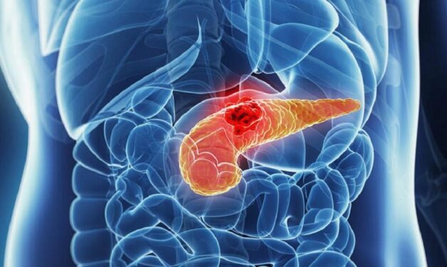 Tìm hiểu về căn bệnh viêm tụy cấp