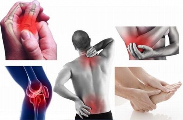 Đau cơ và khớp là tình trạng phổ biến khi mắc bệnh