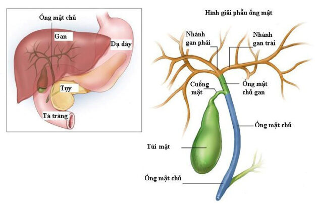 Các bệnh lý đường mật ở người cao tuổi thường bị nhầm lẫn với viêm ruột thừa