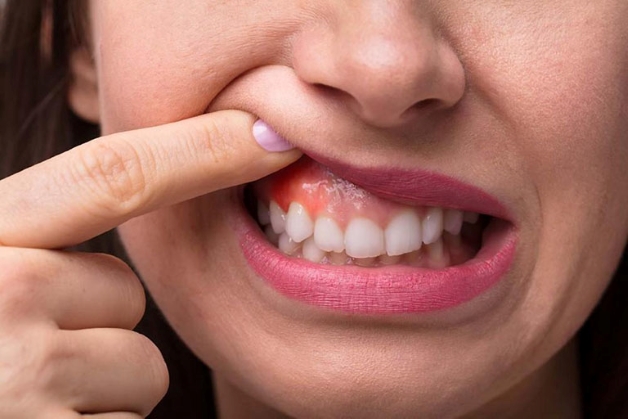 bệnh lý răng miệng trẻ nhỏ