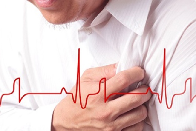 Đau tim, khó thở là một trong những triệu chứng thường gặp ở người bị rối loạn nhịp tim