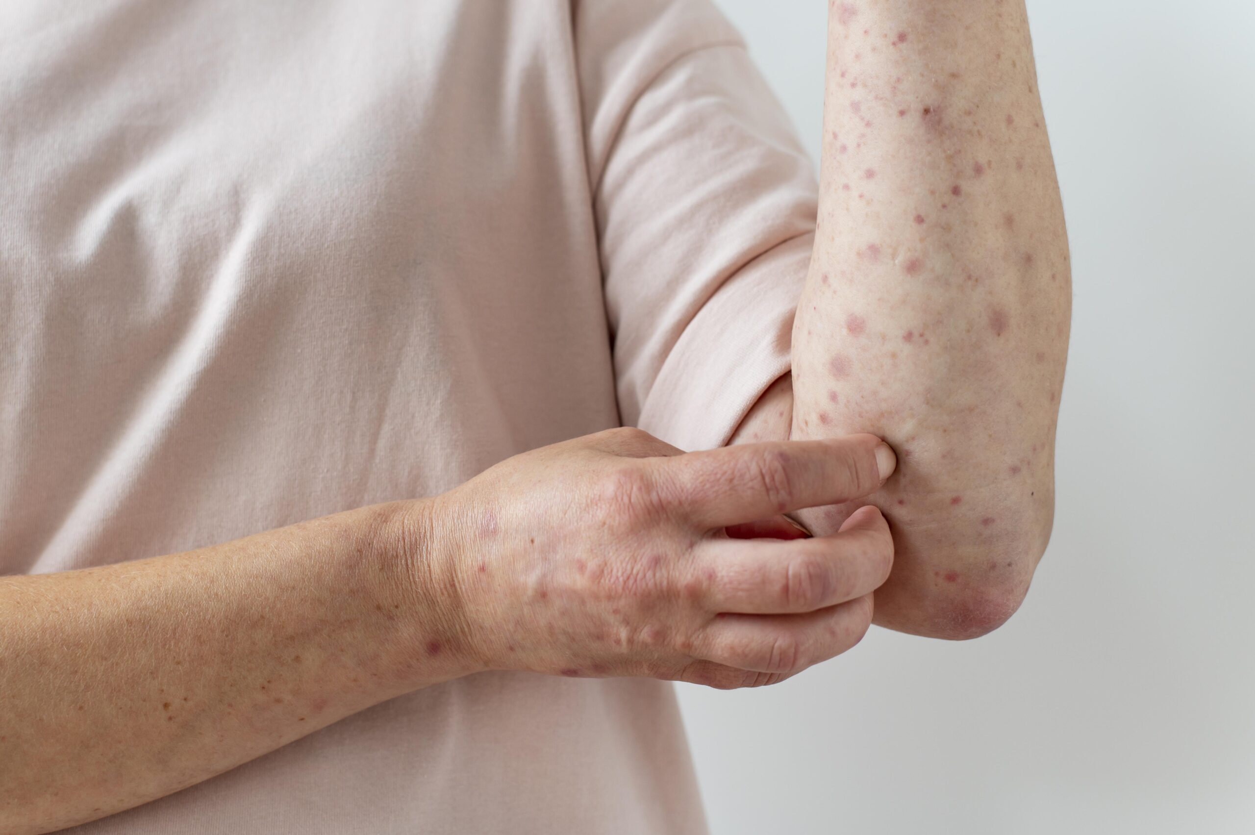Làm thế nào để nhận biết các bệnh lây qua đường tình dục thường gặp