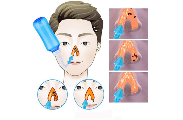 cách chữa viêm xoang mũi hiệu quả