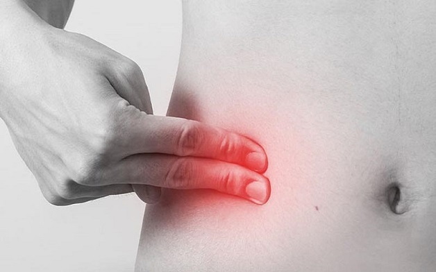 Đau ruột thừa là bệnh lý phổ biến ở hệ tiêu hóa