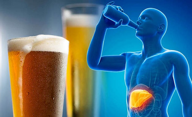 Gan nhiễm mỡ do rượu là một tình trạng mà trong gan tích tụ quá nhiều chất béo do tác động của việc tiêu thụ rượu quà đà