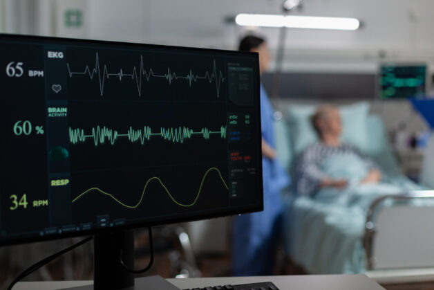 ECG theo dõi hoạt động, nhịp điệu và tốc độ của tim.