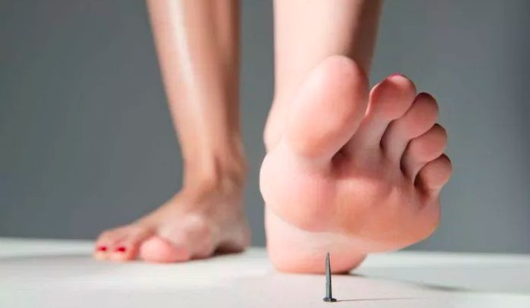 Có nhiều nguyên nhân bị uốn ván ở người và dễ gặp phải với bất kỳ ai