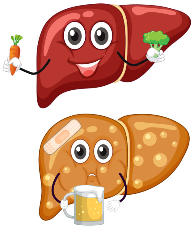 Viêm gan do rượu là tình trạng dung nạp vào cơ thể lượng lớn rượu 