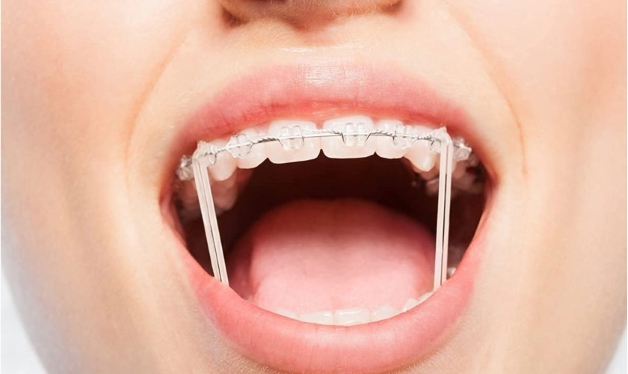 tác dụng của thun liên hàm