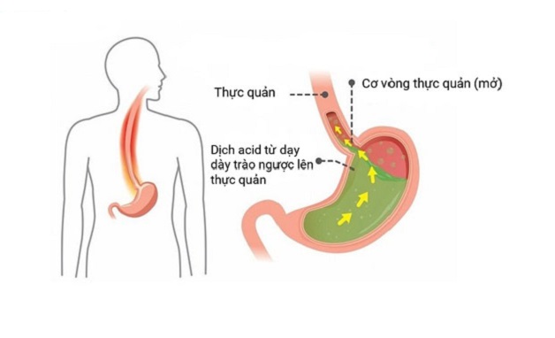 điều trị