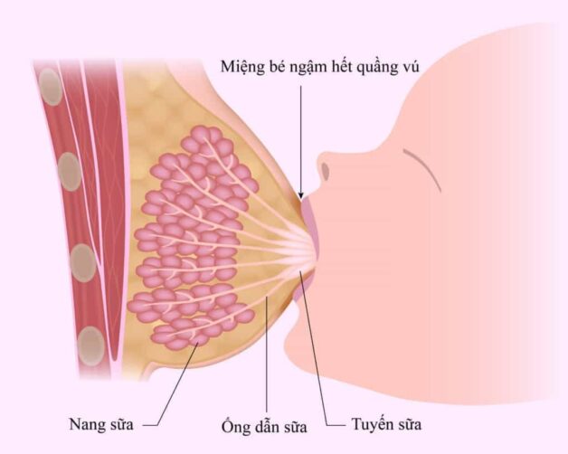 Viêm tuyến vú khi cho con bú