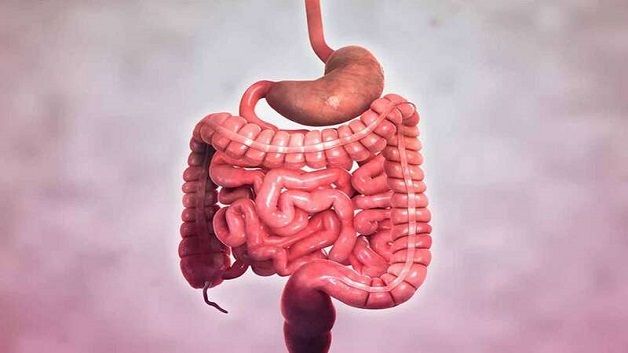 Bệnh Crohn bệnh học là dạng viêm ruột mạn tính