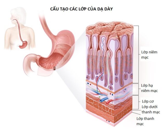 Các giai đoạn ung thư dạ dày tiến triển như thế nào