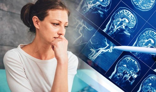 chấn thương đầu có thể gây sa sút trí tuệ não