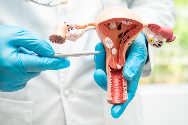Chữa u xơ tử cung bằng Đông y có những ưu điểm và nhược điểm nào?