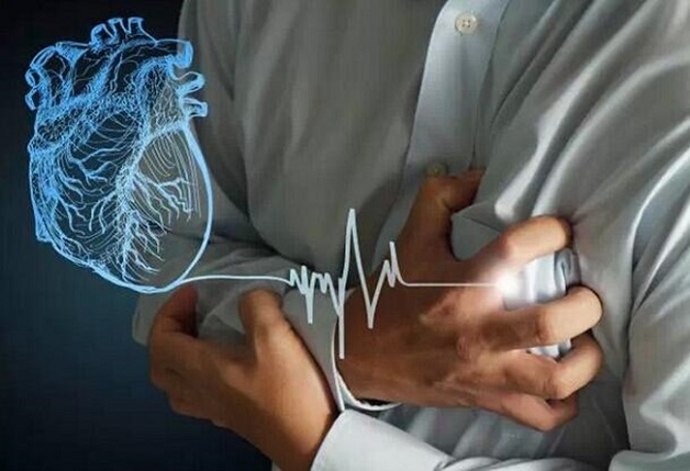 Đột tử và đột quỵ khác nhau về bản chất, nguyên nhân, yếu tố nguy cơ
