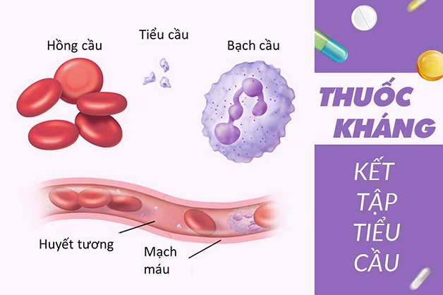 dự phòng tai biến mạch máu não