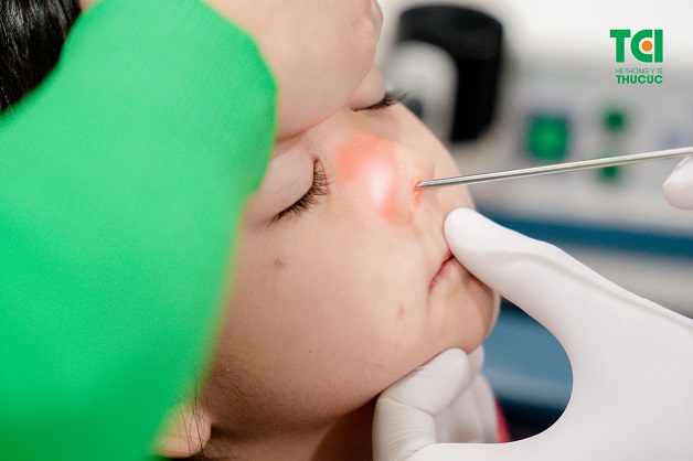 lấy dị vật trong lỗ mũi