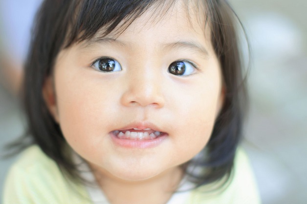 mắt bé bị lác trong