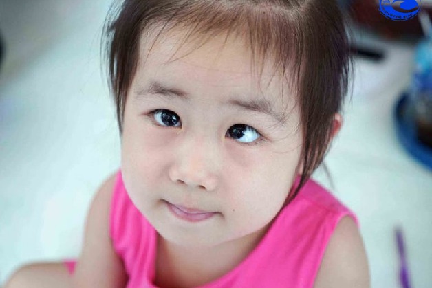 lác mắt ở trẻ