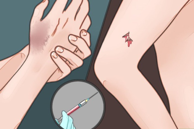 tiêm vaccine