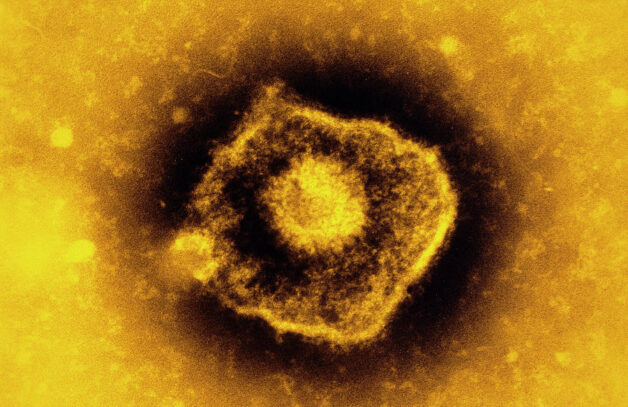 Nguyên nhân phát sinh bệnh truyền nhiễm cấp tính thủy đậu được xác định là virus Varicella-Zoster.