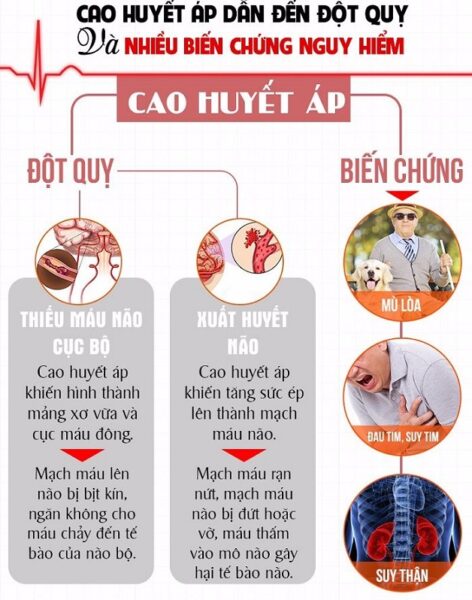 chống đột quỵ