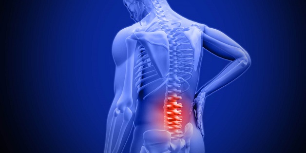 Triệu chứng hẹp ống sống do thoát vị
