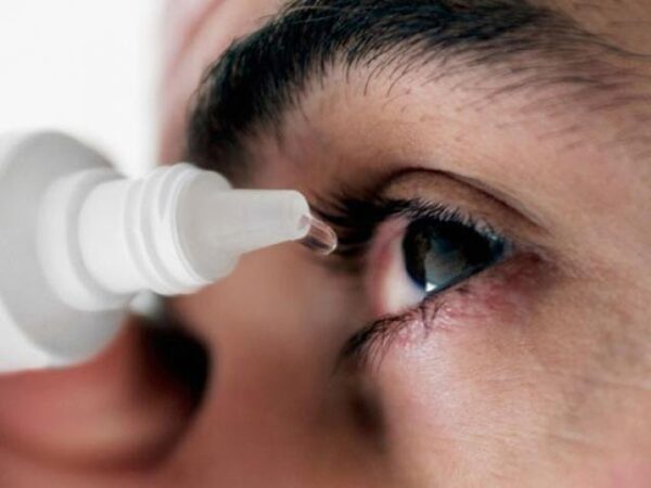 đau mắt đỏ do virus