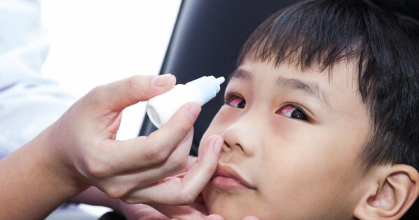 3 cách đơn giản để điều trị đau mắt đỏ mới chớm