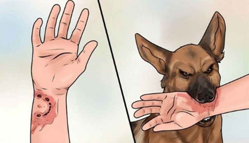 giá vacxin phòng dại