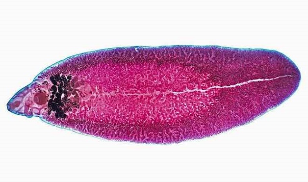 Hình dạng của sán lá gan có đặc điểm: thân dẹt, có hình giống chiếc lá, dài 2 - 5 cm, màu đỏ máu.