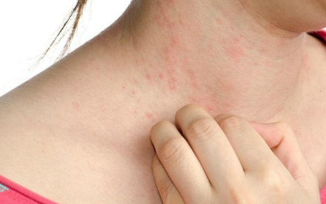 ghép gan cho người bị ung thư - biểu hiện