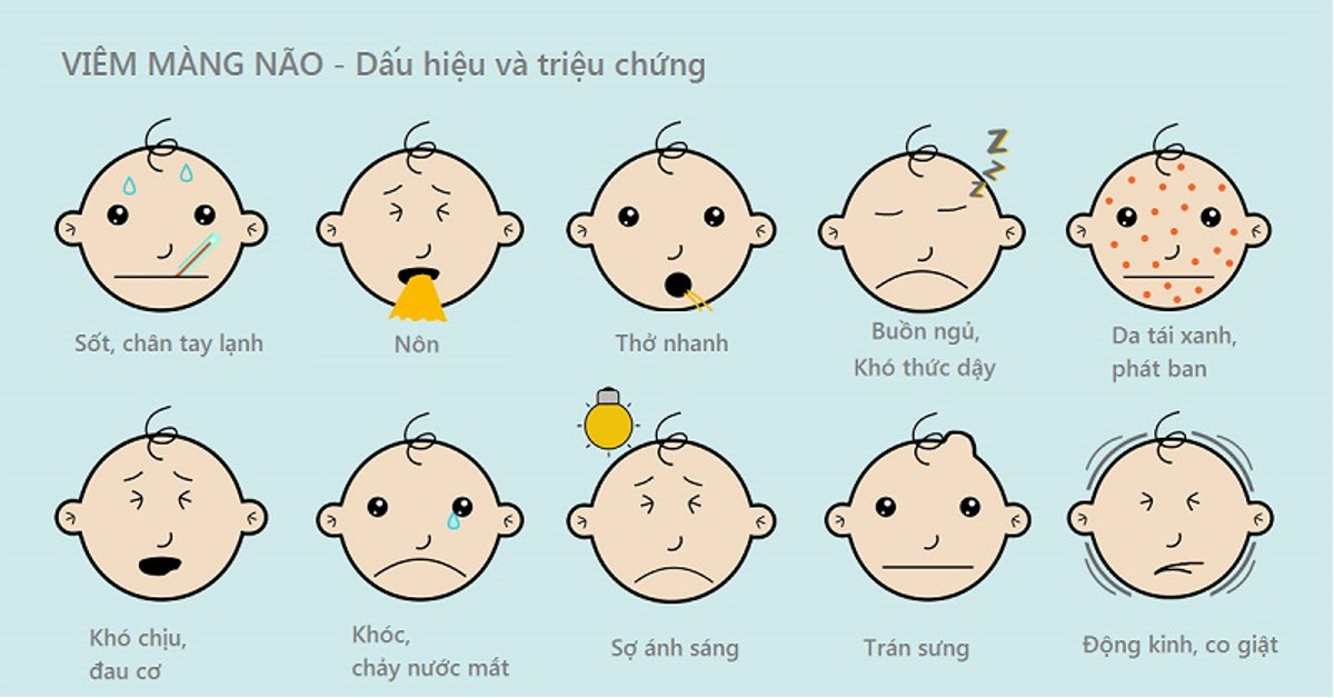 Viêm não mủ có nhiều dấu hiệu nhận nhưng thường bị nhầm lẫn với cảm cúm thông thường