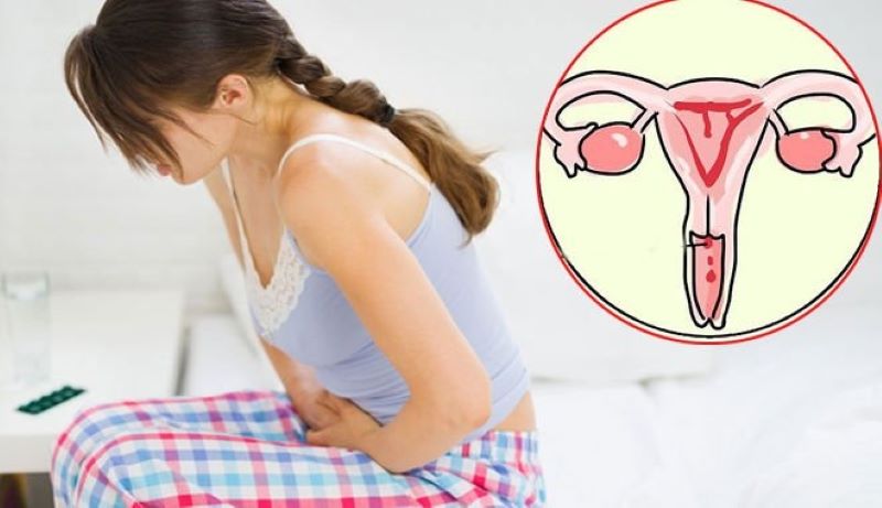 dấu hiệu của bệnh ung thư cổ tử cung