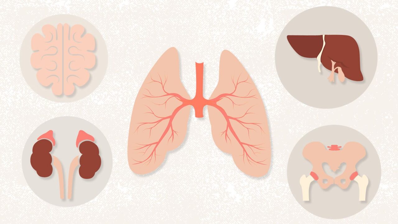 UNG THƯ GAN NGUYÊN PHÁT VÀ THỨ PHÁT KHÁC NHAU VỀ NGUỒN GỐC KHỐI U