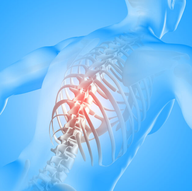 Bệnh viêm cột sống dính khớp gây ra nhiều biến chứng nghiêm trọng.