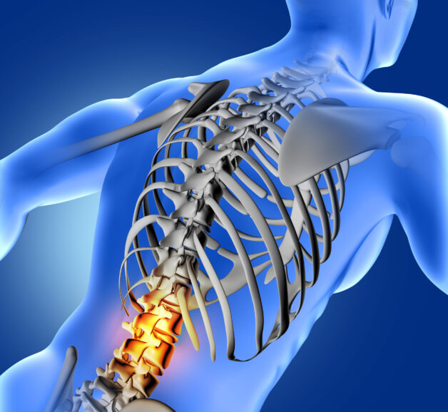 Viêm khớp dạng thấp là một bệnh tự miễn mãn tính