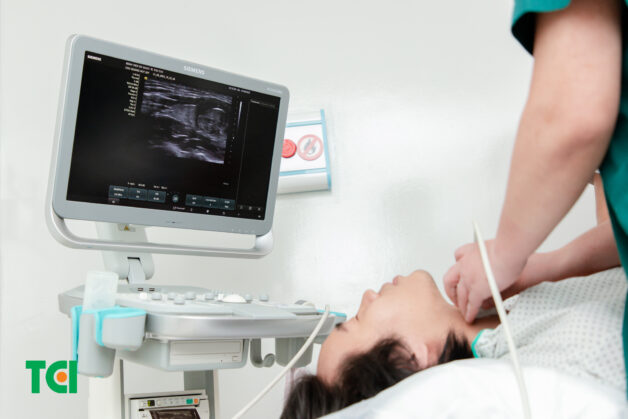 Chọc hút tế bào tuyến giáp để chẩn đoán nhân giáp lành tính hay ác tính