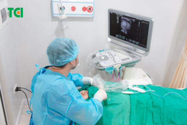 Điều trị u tuyến giáp lành tính bằng đốt sóng cao tần