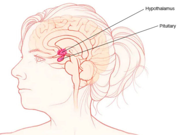 Mục tiêu mổ u tuyến yên chủ yếu để loại bỏ khối u tuyến yên