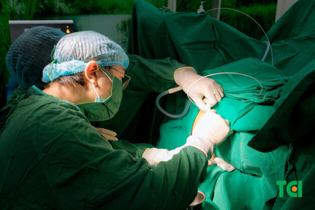 Điều trị trĩ bằng phương pháp mổ trĩ không dao kéo Laser Diode (Ảnh: Bệnh viện ĐKQT Thu Cúc TCI)