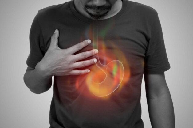 Trào ngược dạ dày thực quản gây khó chịu cho người bệnh