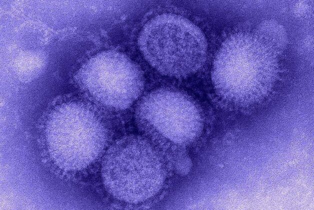 Nguyên nhân phát sinh bệnh cúm ở trẻ em là virus Cúm